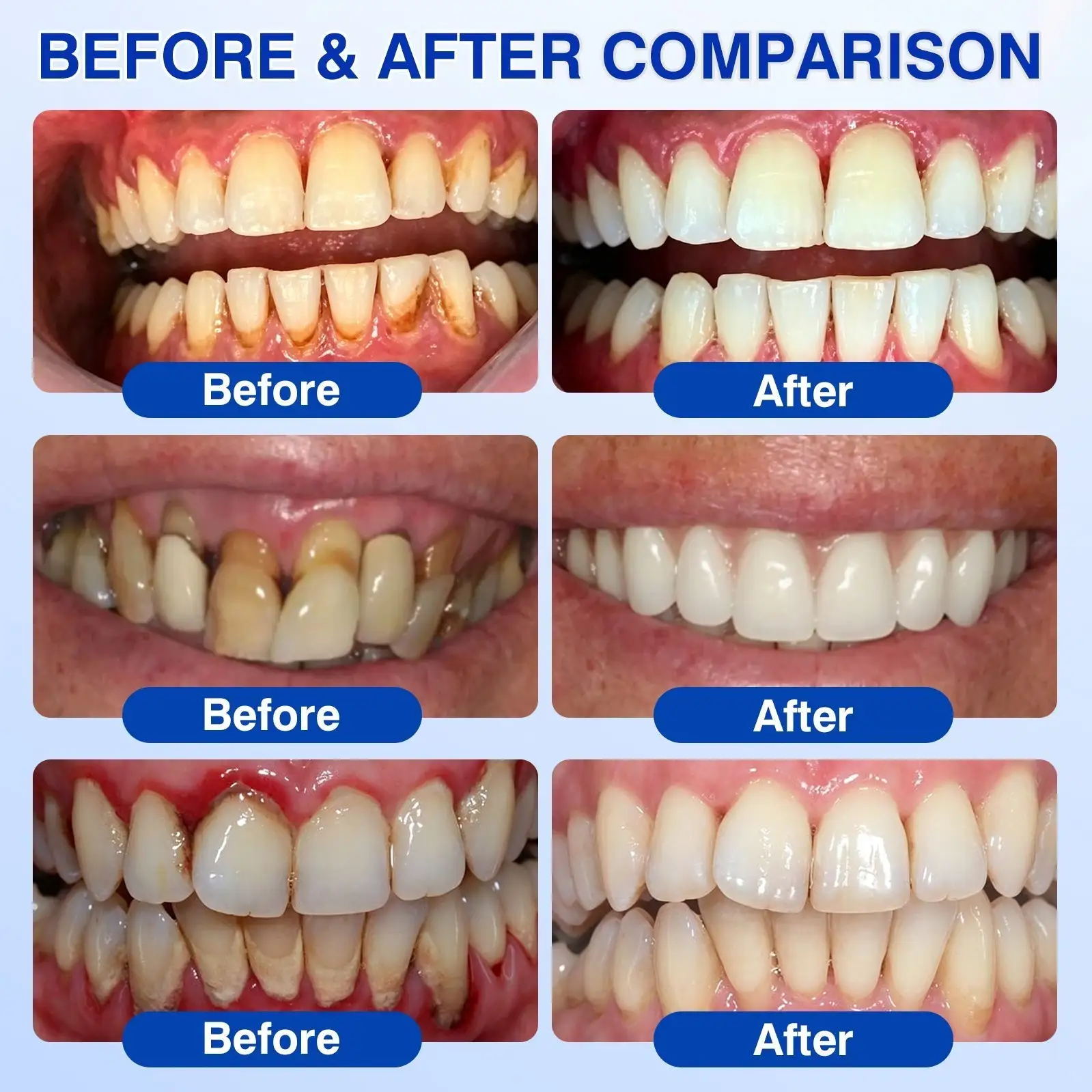 YAGOO® Periodontal Repair Gel