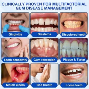 YAGOO® Periodontal Repair Gel