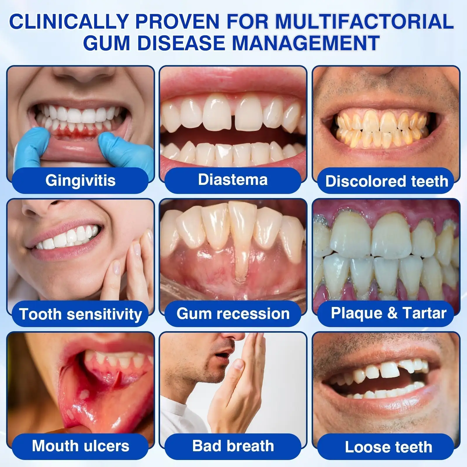 YAGOO® Periodontal Repair Gel