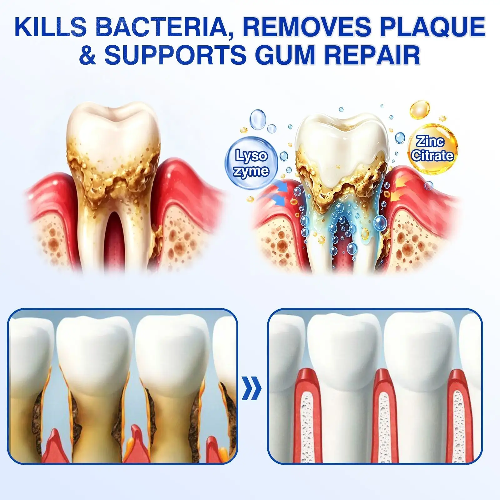 YAGOO® Periodontal Repair Gel